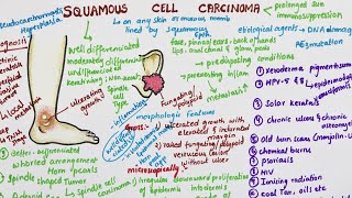 Squamous Cell Carcinoma  Pathology [upl. by Arinay]