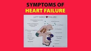 Symptoms of Heart Failure [upl. by Ezirtaeb146]