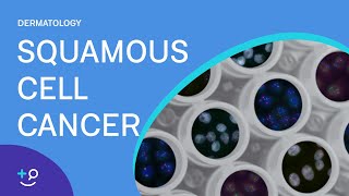 Squamous Cell Cancer Dermatology [upl. by Gould707]