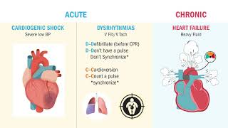 MI  Complications Heart Failure amp V Tach [upl. by Nashbar]