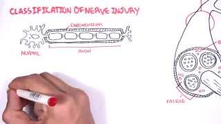 Neurology  Nerve Damage and Regeneration [upl. by Dearman]