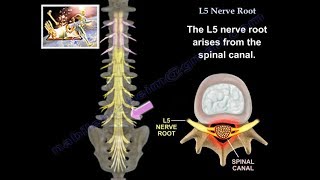 L5 Nerve Root  Everything You Need To Know  Dr Nabil Ebraheim [upl. by Rockefeller]