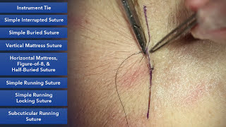 Learn How To Suture  Best Suture Techniques and Training [upl. by Cathyleen772]