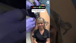 Tattoo Removal Myth VS Fact at Removery [upl. by Anaejer]