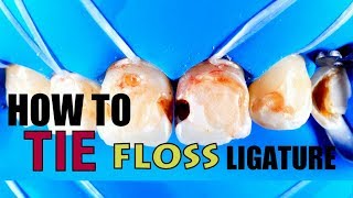 How to Tie Floss Ligature  DEMONSTRATION AND STEP BY STEP [upl. by Guyer18]