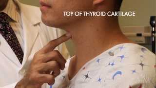 The Thyroid Exam Stanford Medicine 25 [upl. by Dabney]