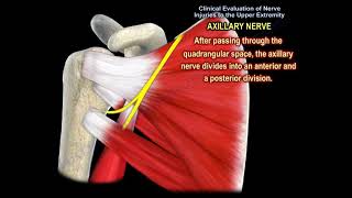 NERVE INJURY IN THE UPPER EXTREMITY Everything You Need To Know  Dr Nabil Ebraheim [upl. by Krigsman766]