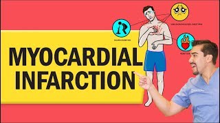 Myocardial Infarction Heart Attack for Nursing amp NCLEX [upl. by Acirretal]